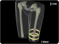 Bioelectric analyses of osseointegrated intelligent implant design